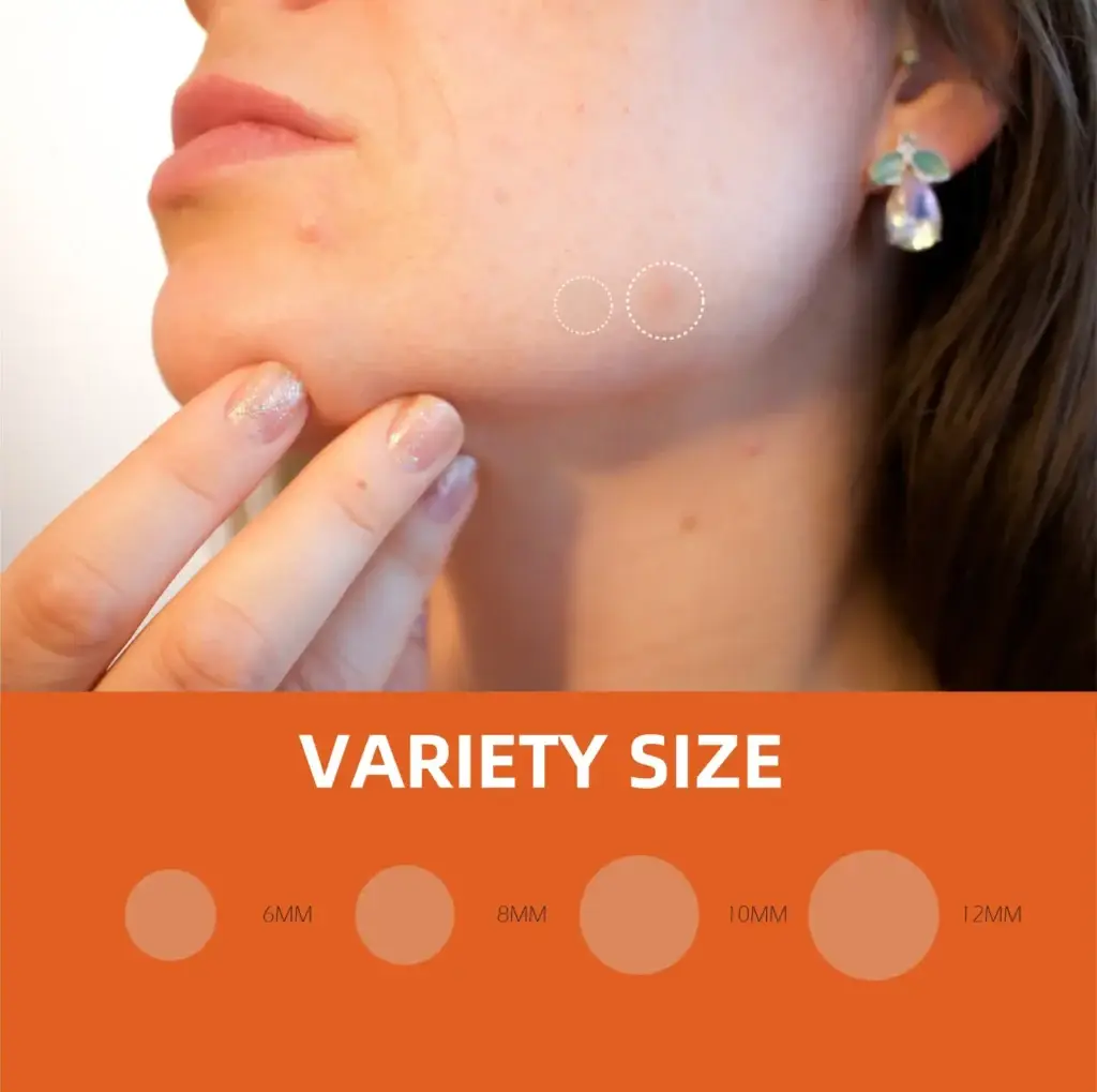 Young lady wearing Pimple Patch Rx demonstrating variety sizes Sigma Essentials acne treatment collection professional pimple patches 4 different sizes S-M-L-XL 324-patch box hydrocolloid salicylic acid calendula tea tree oil