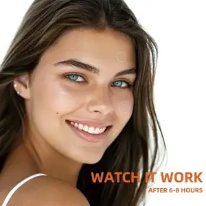 Young lady demonstrating Pimple Patches Rx effectiveness watch it work results 6 hours acne treatment professional pimple patches hydrocolloid salicylic acid calendula tea tree oil