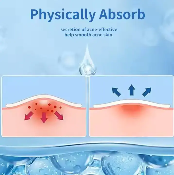 Pimple patch effect demonstration physically absorbs secretion acne effective help smooth acne skin red arrows inflamed pimple blue arrows relief healing process