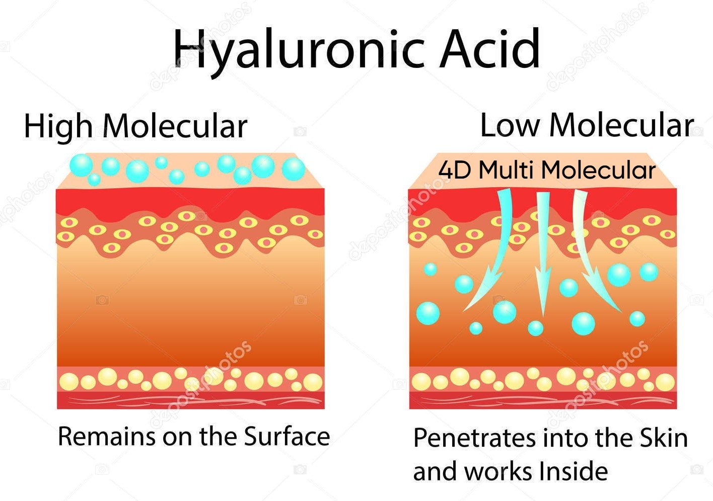 Collagen, Retinol & Hyaluronic Acid Cream (Powerful 5-3-5 Formula) Anti-Aging Moisturizer for Face, Neck & Décolleté – Professional-Grade Daily Moisturizer Face Cream with 4 Different Molecular Weights of Hyaluronic Acid, Each Penetrating Different Skin Layers for Superior Hydration
